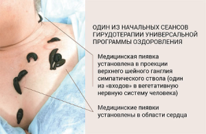 Neron-Picture 6