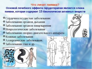 Neron35